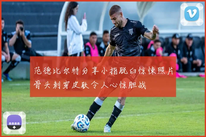 范德比尔特分享小指脱臼惊悚照片骨头刺穿皮肤令人心惊胆战